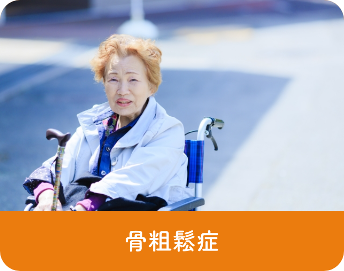 骨粗鬆症